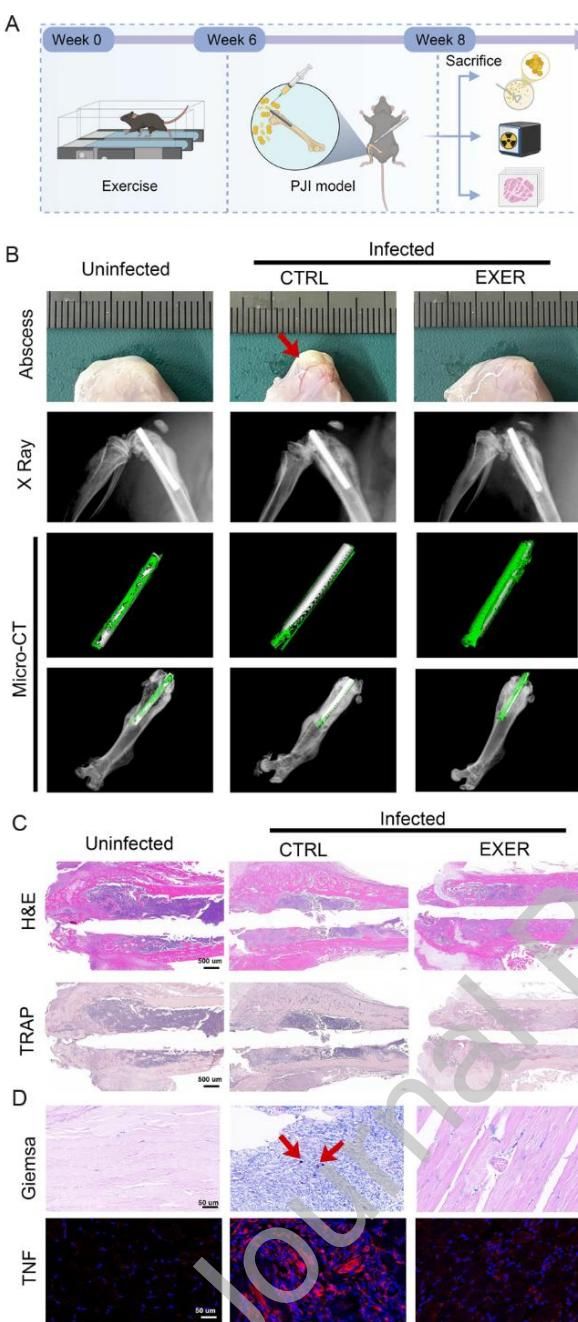 Musclin 换关节后最怕感染:运动产生的Musclin给出新解法 - Suppr | 超能文献